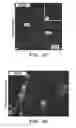 Fig. 15 - METHODS AND COMPOSITIONS FOR THE TREATMENT OR PREVENTION OF PARKINSON'S DISEASE