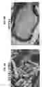 Fig. 06 - OXYGENATED DEMINERALIZED BONE MATRIX FOR USE IN BONE GROWTH