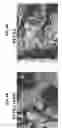 Fig. 07 - OXYGENATED DEMINERALIZED BONE MATRIX FOR USE IN BONE GROWTH