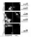 Fig. 10 - MODULATION OF TUMOR IMMUNITY BY PROTEIN-MEDIATED 02 DELIVERY