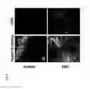 Fig. 11 - MODULATION OF TUMOR IMMUNITY BY PROTEIN-MEDIATED 02 DELIVERY