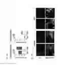 Fig. 12 - MODULATION OF TUMOR IMMUNITY BY PROTEIN-MEDIATED 02 DELIVERY