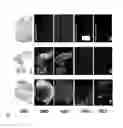 Fig. 14 - MODULATION OF TUMOR IMMUNITY BY PROTEIN-MEDIATED 02 DELIVERY