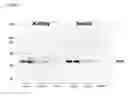 Fig. 03 - Alpha-1-microglobulin for use in the protection of kidneys in radionuclide therapy