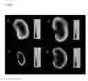 Fig. 09 - Alpha-1-microglobulin for use in the protection of kidneys in radionuclide therapy