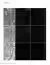 Fig. 11 - Alpha-1-microglobulin for use in the protection of kidneys in radionuclide therapy