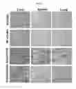 Fig. 12 - METHODS AND COMPOSITIONS FOR TREATMENT OF GAUCHER DISEASE VIA MODULATION OF C5A RECEPTOR