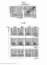 Fig. 19 - METHODS AND COMPOSITIONS FOR TREATMENT OF GAUCHER DISEASE VIA MODULATION OF C5A RECEPTOR