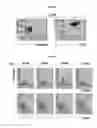 Fig. 20 - METHODS AND COMPOSITIONS FOR TREATMENT OF GAUCHER DISEASE VIA MODULATION OF C5A RECEPTOR