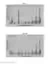 Fig. 21 - METHODS AND COMPOSITIONS FOR TREATMENT OF GAUCHER DISEASE VIA MODULATION OF C5A RECEPTOR