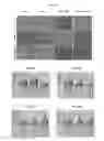 Fig. 24 - METHODS AND COMPOSITIONS FOR TREATMENT OF GAUCHER DISEASE VIA MODULATION OF C5A RECEPTOR