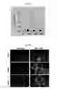 Fig. 31 - METHODS AND COMPOSITIONS FOR TREATMENT OF GAUCHER DISEASE VIA MODULATION OF C5A RECEPTOR