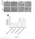 Fig. 04 - Topical erythropoietin formulations and methods for improving wound healing with and cosmetic use of the formulations