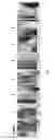 Fig. 14 - Topical erythropoietin formulations and methods for improving wound healing with and cosmetic use of the formulations