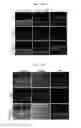 Fig. 03 - Composition for diagnosing, preventing, or treating vascular smooth muscle cell proliferative diseases using FGF12