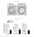 Fig. 17 - Composition for diagnosing, preventing, or treating vascular smooth muscle cell proliferative diseases using FGF12