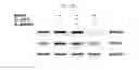 Fig. 22 - Composition for diagnosing, preventing, or treating vascular smooth muscle cell proliferative diseases using FGF12