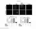 Fig. 25 - Composition for diagnosing, preventing, or treating vascular smooth muscle cell proliferative diseases using FGF12