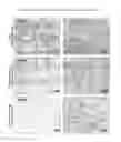 Fig. 27 - Methods of treating diseases associated with fibrosis using modified FGF-21 polypeptides and uses thereof