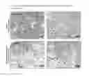 Fig. 28 - Methods of treating diseases associated with fibrosis using modified FGF-21 polypeptides and uses thereof