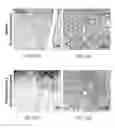 Fig. 55 - Methods of treating diseases associated with fibrosis using modified FGF-21 polypeptides and uses thereof