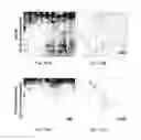 Fig. 57 - Methods of treating diseases associated with fibrosis using modified FGF-21 polypeptides and uses thereof