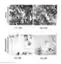 Fig. 63 - Methods of treating diseases associated with fibrosis using modified FGF-21 polypeptides and uses thereof