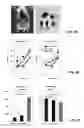 Fig. 06 - Treating cardiovascular or renal diseases