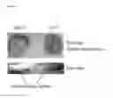 Fig. 15 - Rapid action insulin formulations and pharmaceutical delivery systems