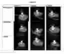 Fig. 08 - Formation of bone