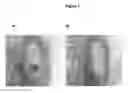 Fig. 09 - Formation of bone