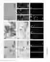 Fig. 31 - Methods for inducing partial apoptosis using caspase polypeptides