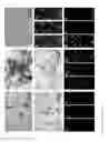 Fig. 31 - Methods for inducing selective apoptosis