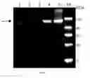 Fig. 09 - Fusion proteins comprising modified alpha virus surface glycoproteins and tumor associated antigen and methods thereof