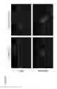 Fig. 12 - Inflammasome activators and methods of use to treat tumors