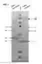 Fig. 04 - Compositions and methods for detecting, treating, and protecting against infection