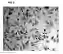 Fig. 10 - Compositions and methods for detecting, treating, and protecting against infection