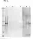 Fig. 15 - Compositions and methods for detecting, treating, and protecting against infection