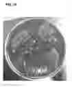 Fig. 21 - Compositions and methods for detecting, treating, and protecting against infection