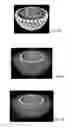 Fig. 05 - SYSTEMS AND METHODS FOR TARGETED CANCER THERAPIES