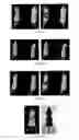 Fig. 07 - PSMA binding ligand-linker conjugates and methods for using