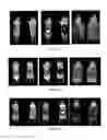 Fig. 08 - PSMA binding ligand-linker conjugates and methods for using