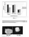 Fig. 05 - Composition and method for detection of demineralisation