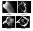 Fig. 07 - Composition and method for detection of demineralisation
