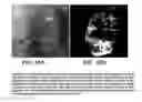 Fig. 11 - Composition and method for detection of demineralisation