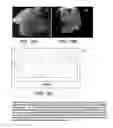Fig. 12 - Composition and method for detection of demineralisation
