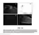 Fig. 14 - Composition and method for detection of demineralisation