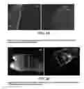 Fig. 15 - Composition and method for detection of demineralisation