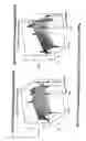 Fig. 13 - Implant for tissue repair including chitosan