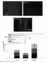 Fig. 01 - Bi-Layer Extra Cellular Matrix Scaffolds and Uses Therefor